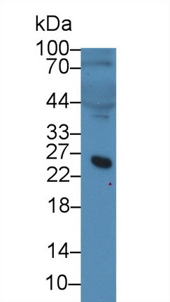 Polyclonal Antibody to Microfibrillar Associated Protein 5 (MFAP5)