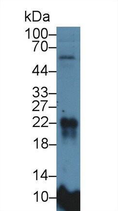 Polyclonal Antibody to Microfibrillar Associated Protein 5 (MFAP5)