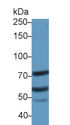 Polyclonal Antibody to Metastasis Associated Protein 2 (MTA2)