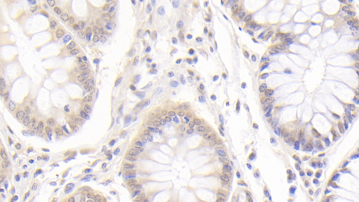 Polyclonal Antibody to Metastasis Associated Protein 2 (MTA2)