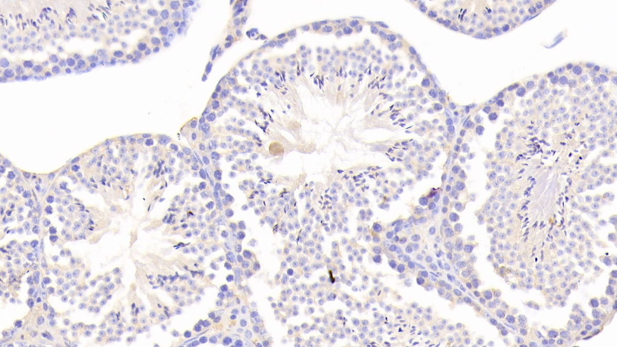 Polyclonal Antibody to Chordin Like Protein 1 (CHRDL1)