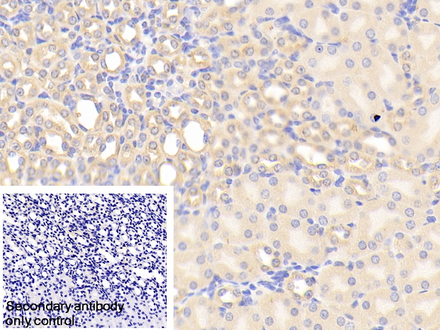 Polyclonal Antibody to Chordin Like Protein 1 (CHRDL1)