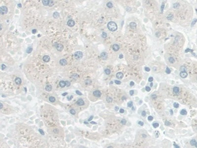 Polyclonal Antibody to Phosphodiesterase 1A, Calmodulin Dependent (PDE1A)