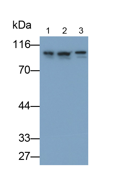 Polyclonal Antibody to Phosphodiesterase 4D, cAMP Specific (PDE4D)