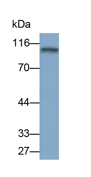 Polyclonal Antibody to Phosphodiesterase 5A, cGMP Specific (PDE5A)