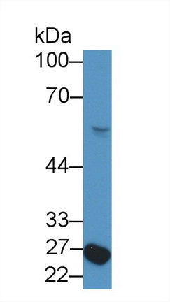 Polyclonal Antibody to Nuclear Factor I/X (NFIX)