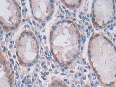 Polyclonal Antibody to 2',5'-Oligoadenylate Synthetase 2 (OAS2)