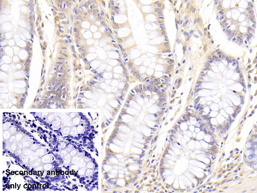 Polyclonal Antibody to Peptidyl Arginine Deiminase Type II (PADI2)