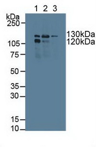 Polyclonal Antibody to Polymerase DNA Directed Gamma 1 (POLg1)