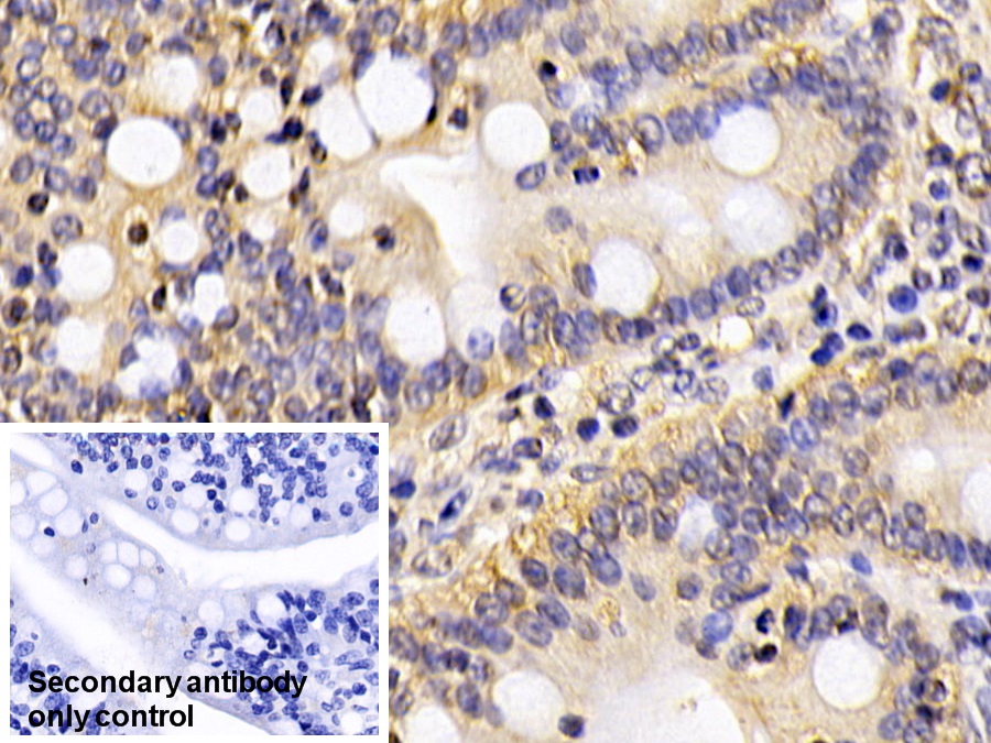 Polyclonal Antibody to Polymerase DNA Directed Gamma 1 (POLg1)