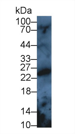 Polyclonal Antibody to Peroxiredoxin 3 (PRDX3)