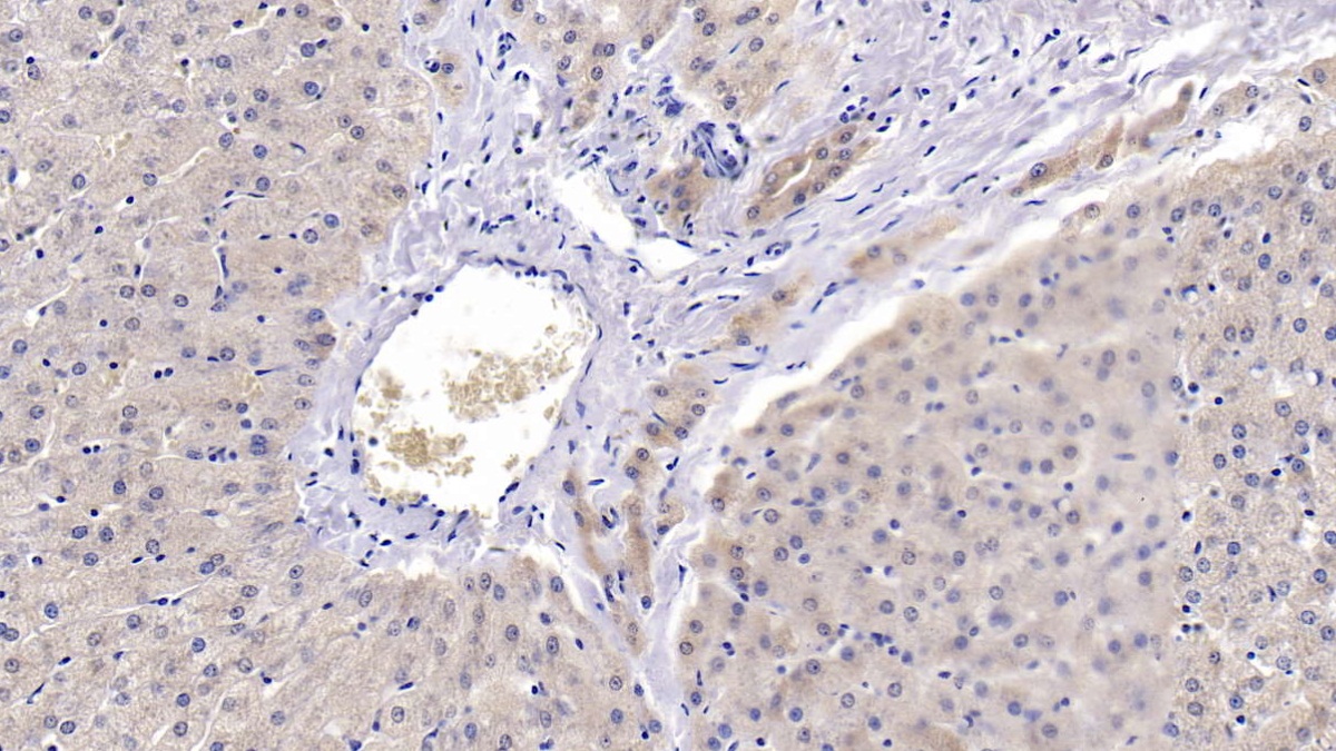 Polyclonal Antibody to Peroxiredoxin 3 (PRDX3)