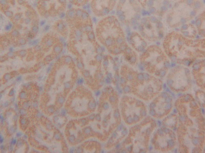 Polyclonal Antibody to Peroxiredoxin 3 (PRDX3)