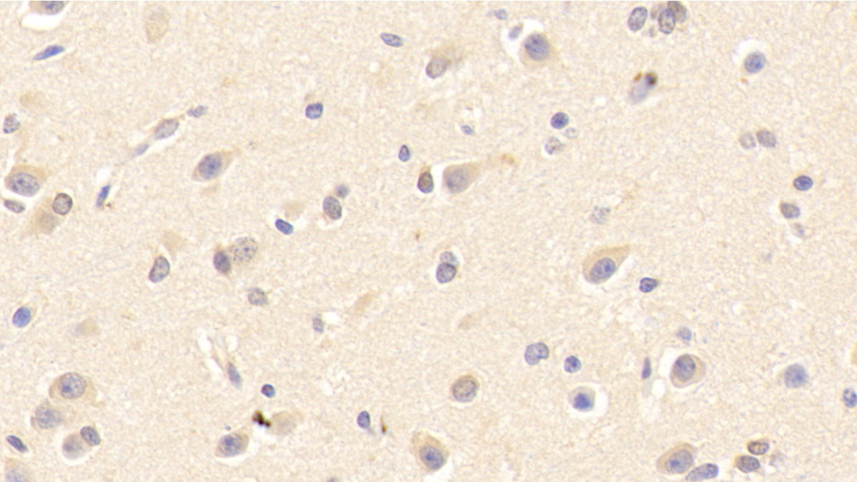 Polyclonal Antibody to Peroxiredoxin 4 (PRDX4)