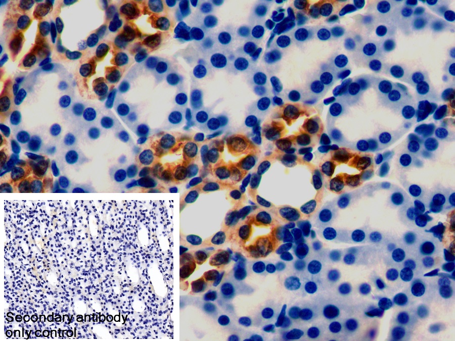 Polyclonal Antibody to Peroxiredoxin 5 (PRDX5)