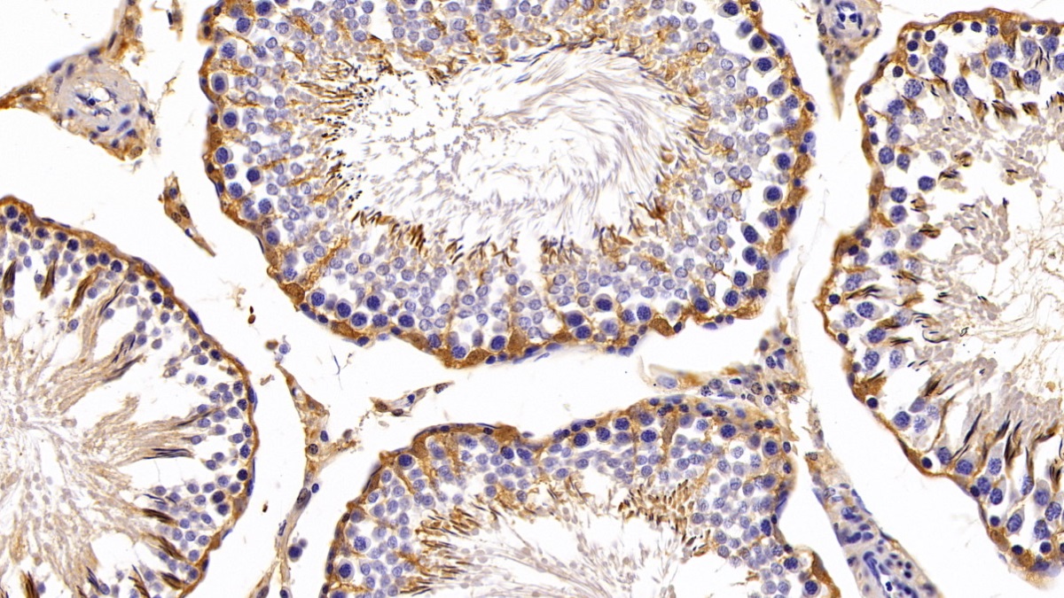 Polyclonal Antibody to Peroxiredoxin 2 (PRDX2)