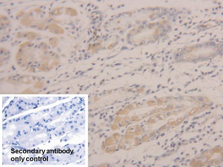 Polyclonal Antibody to Peroxiredoxin 2 (PRDX2)