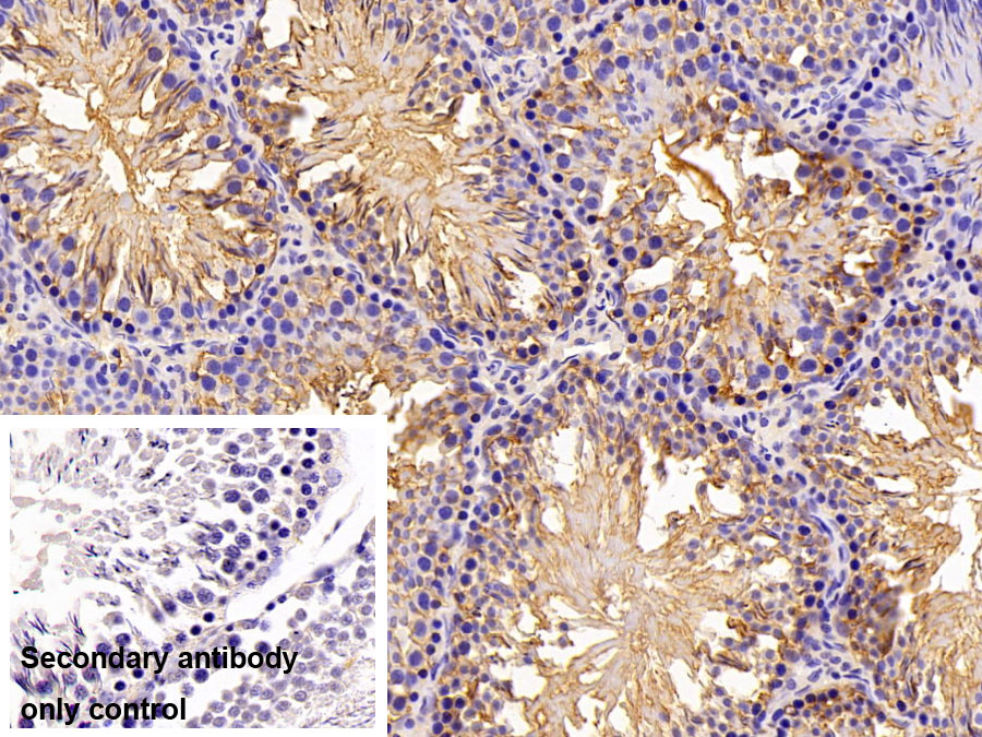 Polyclonal Antibody to Peroxiredoxin 2 (PRDX2)