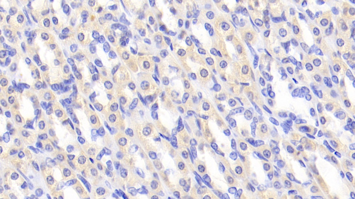 Polyclonal Antibody to Peroxiredoxin 2 (PRDX2)