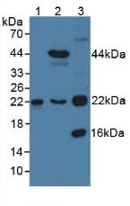 Polyclonal Antibody to Transgelin 2 (TAGLN2)