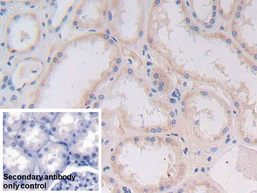 Polyclonal Antibody to Transgelin 2 (TAGLN2)