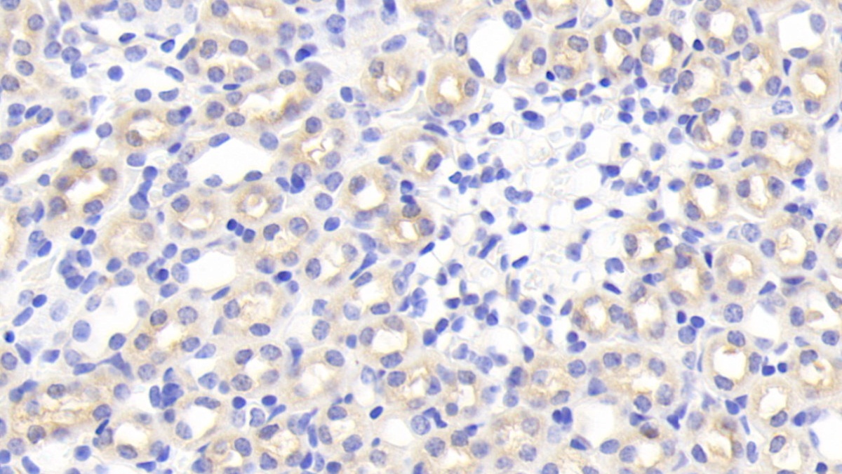 Polyclonal Antibody to Tumor Necrosis Factor Alpha Induced Protein 3 Interacting Protein 2 (TNIP2)