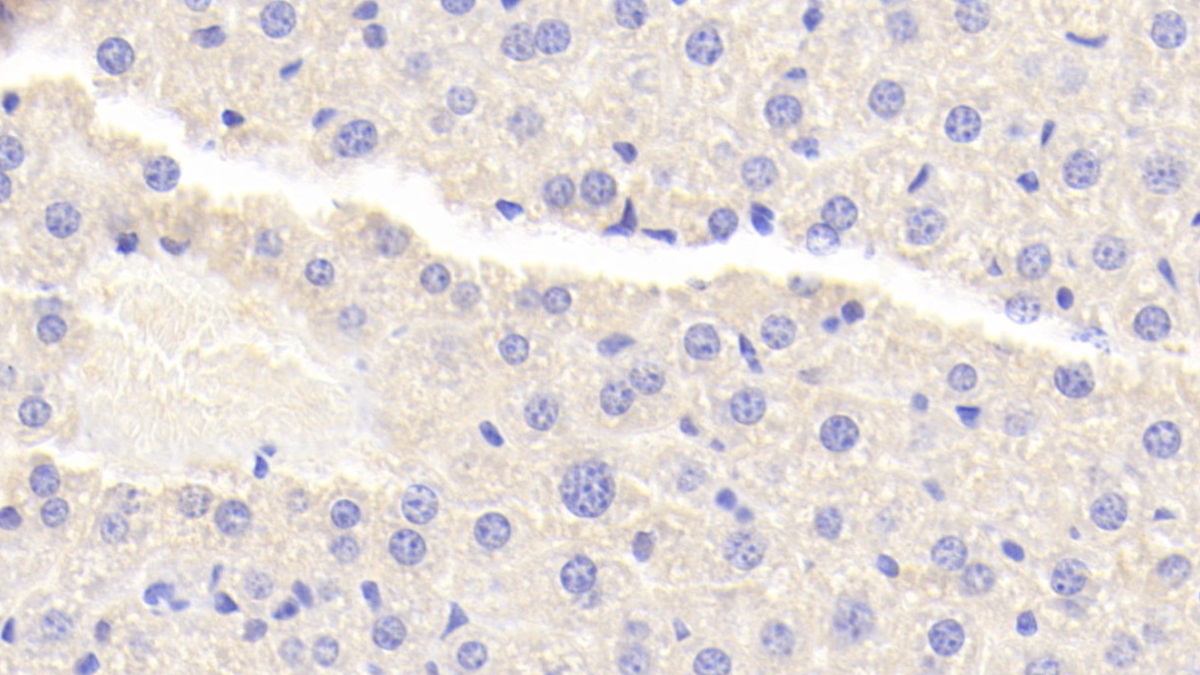 Polyclonal Antibody to Tumor Necrosis Factor Alpha Induced Protein 3 Interacting Protein 2 (TNIP2)