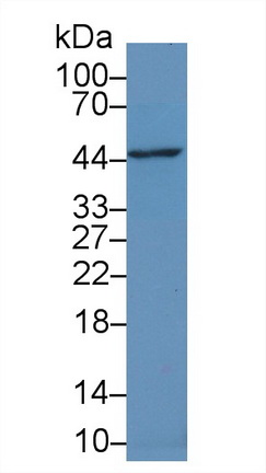 Polyclonal Antibody to Tumor Necrosis Factor Alpha Induced Protein 3 Interacting Protein 2 (TNIP2)