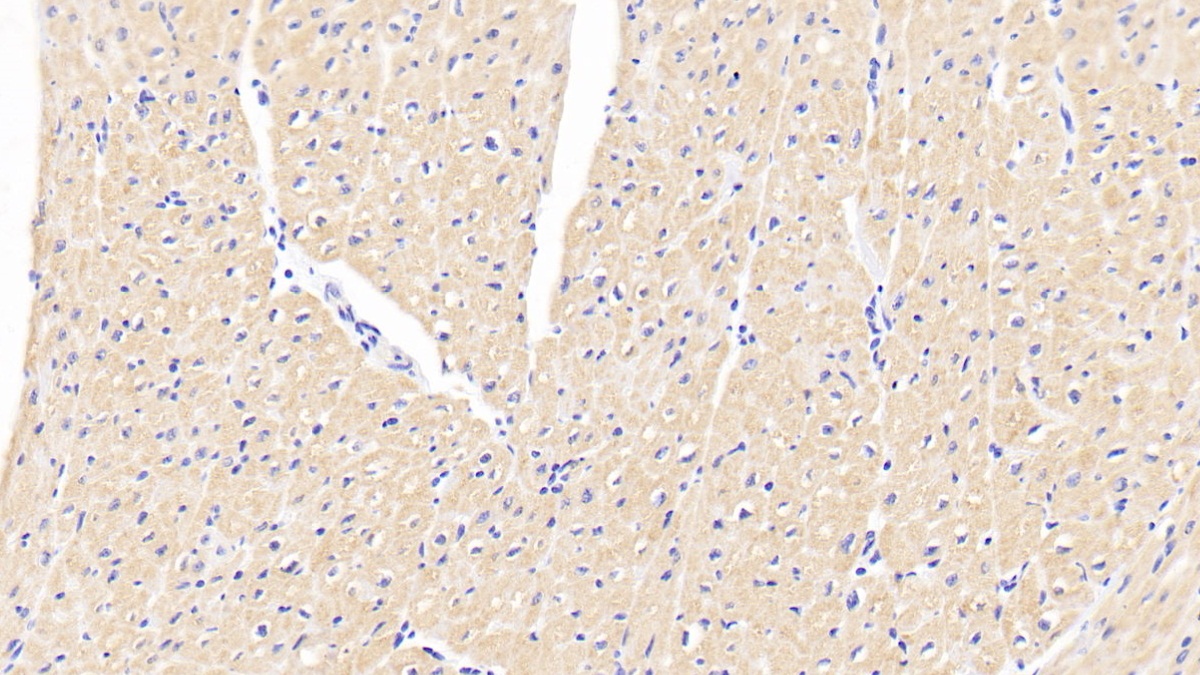 Polyclonal Antibody to Tensin 3 (TNS3)