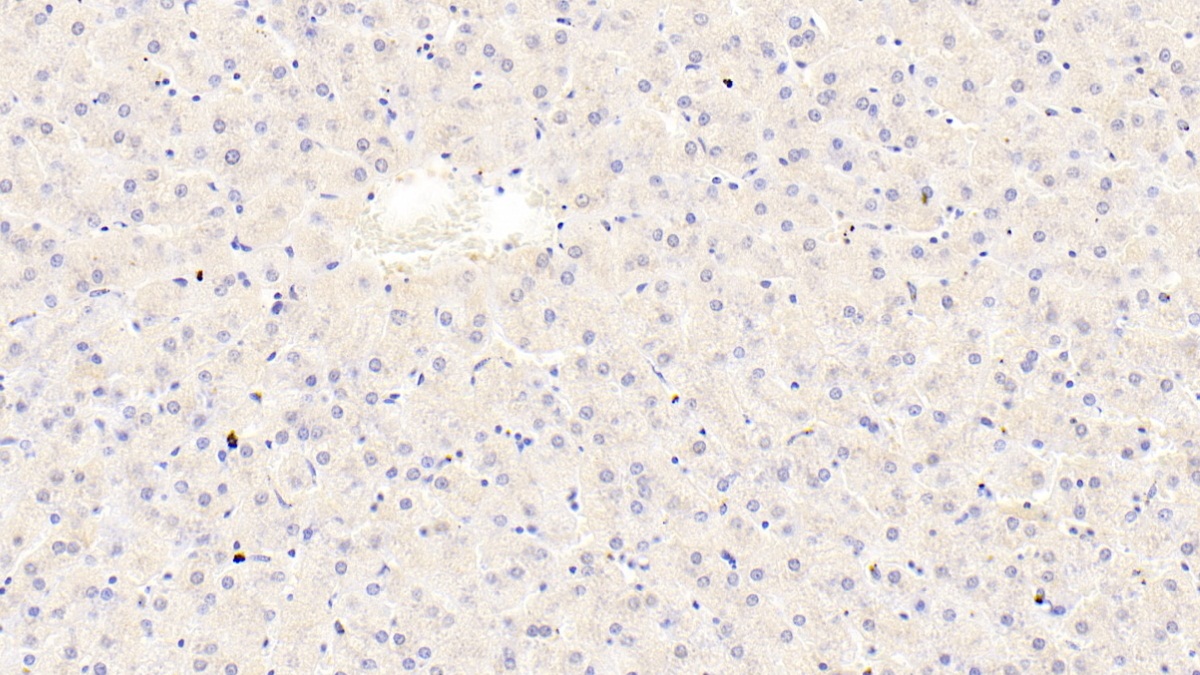 Polyclonal Antibody to Transient Receptor Potential Cation Channel Subfamily A, Member 1 (TRPA1)