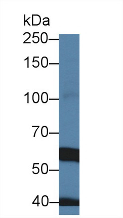 Polyclonal Antibody to Transient Receptor Potential Cation Channel Subfamily M, Member 7 (TRPM7)