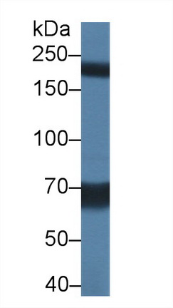 Polyclonal Antibody to Transient Receptor Potential Cation Channel Subfamily M, Member 7 (TRPM7)