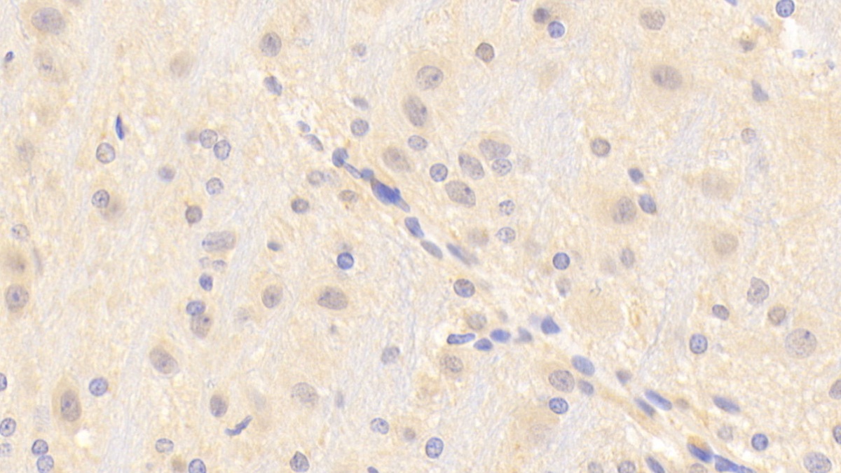 Polyclonal Antibody to Transient Receptor Potential Cation Channel Subfamily M, Member 7 (TRPM7)