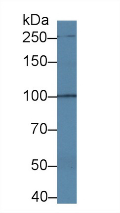 Polyclonal Antibody to Transient Receptor Potential Cation Channel Subfamily C, Member 6 (TRPC6)