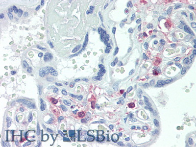 Polyclonal Antibody to Transient Receptor Potential Cation Channel Subfamily C, Member 6 (TRPC6)