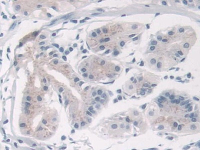 Polyclonal Antibody to Transient Receptor Potential Cation Channel Subfamily C, Member 6 (TRPC6)