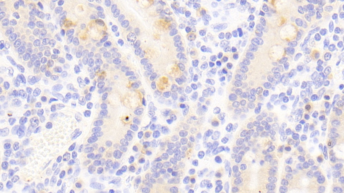 Polyclonal Antibody to Secretogranin III (SCG3)