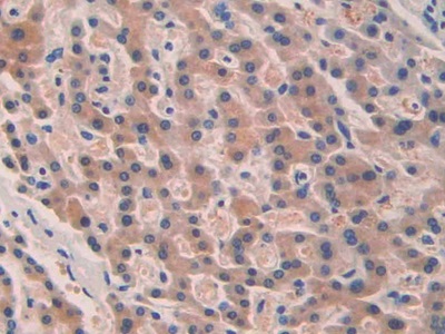 Polyclonal Antibody to Septin 5 (SEPT5)