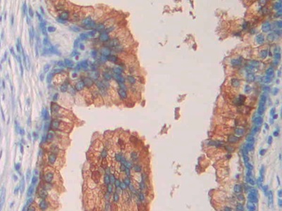 Polyclonal Antibody to Septin 5 (SEPT5)