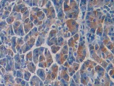 Polyclonal Antibody to Septin 5 (SEPT5)