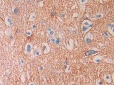 Polyclonal Antibody to Septin 5 (SEPT5)