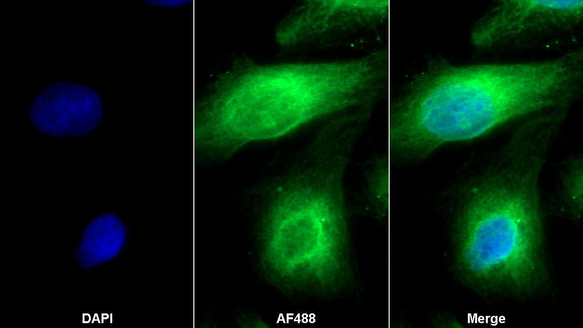 Polyclonal Antibody to Septin 5 (SEPT5)