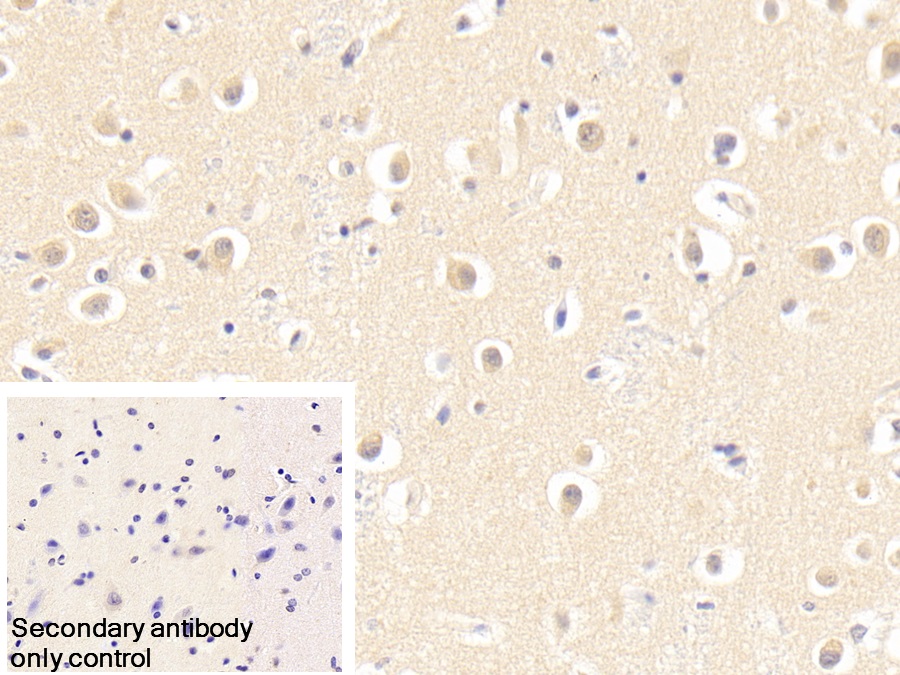 Polyclonal Antibody to S-Phase Kinase Associated Protein 1 (SKP1)