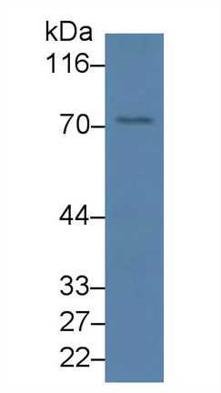 Polyclonal Antibody to Syncoilin (SYNC)