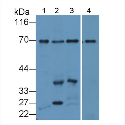 Polyclonal Antibody to Syncoilin (SYNC)