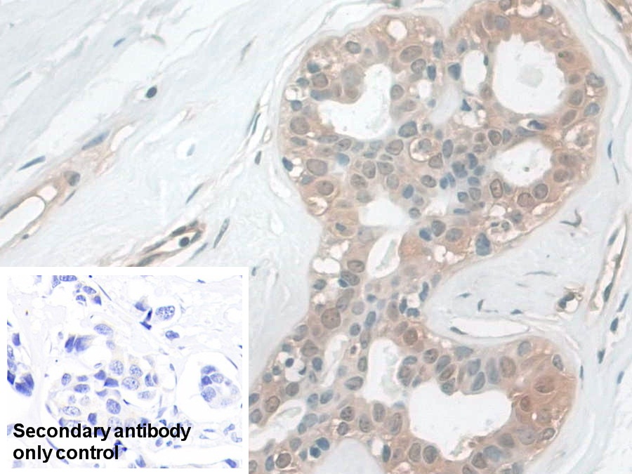 Polyclonal Antibody to Calmodulin Like Protein 5 (CALML5)