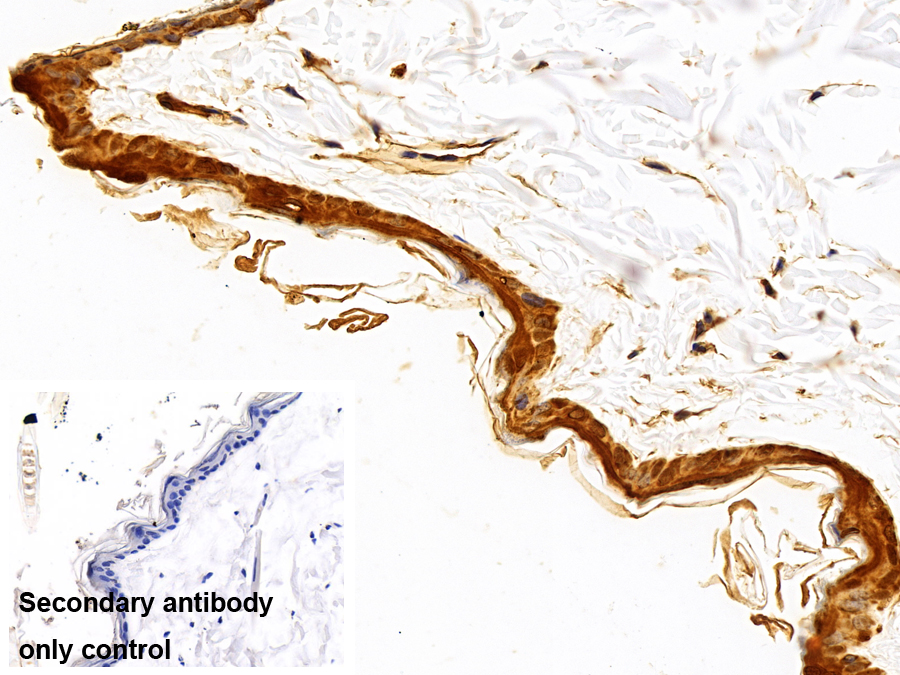 Polyclonal Antibody to Calmodulin Like Protein 5 (CALML5)