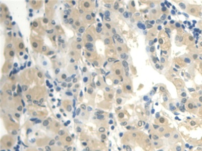 Polyclonal Antibody to Calmodulin Like Protein 3 (CALML3)