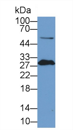 Polyclonal Antibody to Stanniocalcin 2 (STC2)