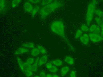 Polyclonal Antibody to Ribonucleotide Reductase M1 (RRM1)